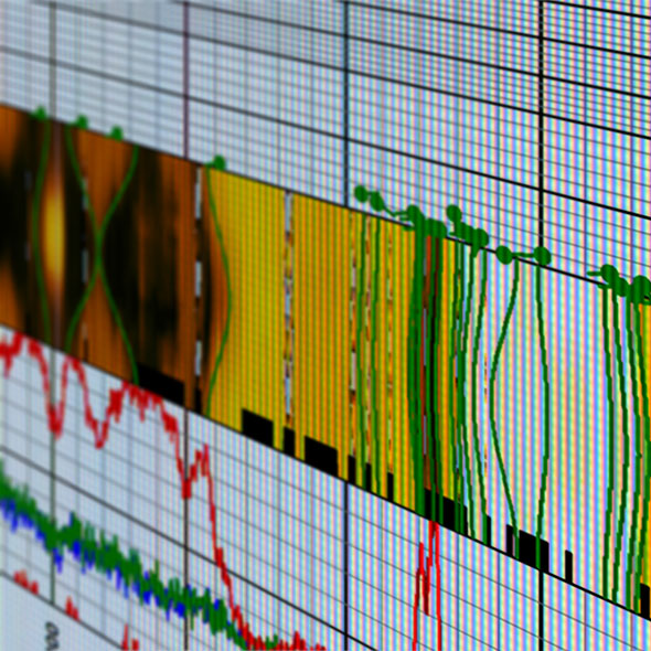 Spectral Gamma Logging